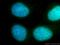 ZW10 Interacting Kinetochore Protein antibody, 12282-2-AP, Proteintech Group, Immunofluorescence image 