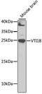 Vesicle Transport Through Interaction With T-SNAREs 1B antibody, GTX32969, GeneTex, Western Blot image 