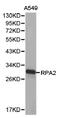 RPA32 antibody, LS-C193098, Lifespan Biosciences, Western Blot image 
