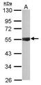 Inositol-Pentakisphosphate 2-Kinase antibody, PA5-29411, Invitrogen Antibodies, Western Blot image 