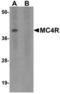 Melanocortin receptor 4 antibody, TA306791, Origene, Western Blot image 