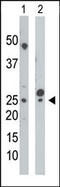 UMP/CMPK antibody, 63-410, ProSci, Western Blot image 