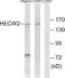 HECT, C2 And WW Domain Containing E3 Ubiquitin Protein Ligase 2 antibody, A08779, Boster Biological Technology, Western Blot image 