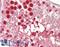 Zinc finger protein 198 antibody, LS-B12337, Lifespan Biosciences, Immunohistochemistry paraffin image 
