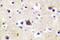 Nuclear Receptor Subfamily 3 Group C Member 1 antibody, LS-C176280, Lifespan Biosciences, Immunohistochemistry frozen image 