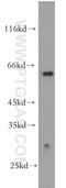 Katanin Catalytic Subunit A1 antibody, 17560-1-AP, Proteintech Group, Western Blot image 
