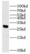 Phospholipid Phosphatase 7 (Inactive) antibody, FNab06659, FineTest, Western Blot image 