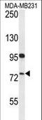 Helicase For Meiosis 1 antibody, LS-C166853, Lifespan Biosciences, Western Blot image 