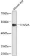 Transcription Factor AP-2 Alpha antibody, 13-168, ProSci, Western Blot image 