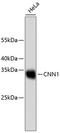 Calponin 1 antibody, 13-818, ProSci, Western Blot image 