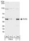 PHD Finger Protein 6 antibody, A301-451A, Bethyl Labs, Western Blot image 