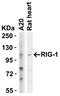 DExD/H-Box Helicase 58 antibody, A00244, Boster Biological Technology, Western Blot image 