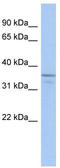 Ubiquitin Like Domain Containing CTD Phosphatase 1 antibody, TA340383, Origene, Western Blot image 