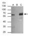 Cerebellar Degeneration Related Protein 2 antibody, GTX129122, GeneTex, Immunoprecipitation image 