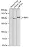Retinol-binding protein 3 antibody, 22-193, ProSci, Western Blot image 