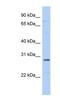 Small Nuclear Ribonucleoprotein Polypeptide A' antibody, NBP1-57240, Novus Biologicals, Western Blot image 