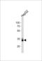 3-mercaptopyruvate sulfurtransferase antibody, 63-102, ProSci, Western Blot image 
