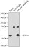 Hippocalcin-like protein 1 antibody, GTX64929, GeneTex, Immunoprecipitation image 