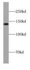 DIAPH1 antibody, FNab02385, FineTest, Western Blot image 