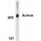 Apoptotic Chromatin Condensation Inducer 1 antibody, PA1-30552, Invitrogen Antibodies, Western Blot image 