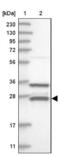 ETHE1 Persulfide Dioxygenase antibody, NBP1-81690, Novus Biologicals, Western Blot image 