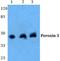 Peroxisomal biogenesis factor 3 antibody, PA5-37012, Invitrogen Antibodies, Western Blot image 