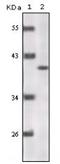 Cyclin-dependent kinase inhibitor 2A, isoforms 1/2/3 antibody, LS-B11729, Lifespan Biosciences, Western Blot image 