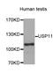 Ubiquitin Specific Peptidase 11 antibody, MBS128990, MyBioSource, Western Blot image 