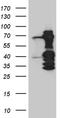 SET1 antibody, TA810989S, Origene, Western Blot image 