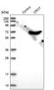 Peroxisomal carnitine O-octanoyltransferase antibody, PA5-53906, Invitrogen Antibodies, Western Blot image 