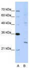 EXOSC4 antibody, TA343890, Origene, Western Blot image 