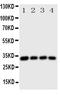 Mitochondrial brown fat uncoupling protein 1 antibody, PA1981, Boster Biological Technology, Western Blot image 