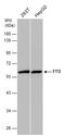 FTO Alpha-Ketoglutarate Dependent Dioxygenase antibody, GTX131517, GeneTex, Western Blot image 