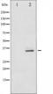 Cyclin Dependent Kinase 5 antibody, TA325346, Origene, Western Blot image 