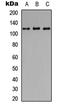 Lysosomal Associated Membrane Protein 1 antibody, LS-C356157, Lifespan Biosciences, Western Blot image 