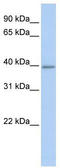 Thioredoxin Interacting Protein antibody, TA340115, Origene, Western Blot image 