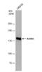 Anillin antibody, NBP1-31060, Novus Biologicals, Western Blot image 