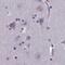Amidohydrolase Domain Containing 2 antibody, PA5-59474, Invitrogen Antibodies, Immunohistochemistry paraffin image 