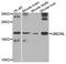 Ubiquitin Conjugating Enzyme E2 N Like (Gene/Pseudogene) antibody, MBS9128547, MyBioSource, Western Blot image 