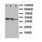 Discoidin Domain Receptor Tyrosine Kinase 2 antibody, orb97006, Biorbyt, Western Blot image 