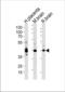 Junctional Adhesion Molecule 3 antibody, TA328124, Origene, Western Blot image 