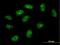 Translation Machinery Associated 16 Homolog antibody, H00055319-B01P, Novus Biologicals, Immunofluorescence image 