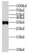 Pyrroline-5-Carboxylate Reductase 2 antibody, FNab06971, FineTest, Western Blot image 