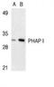 Acidic Nuclear Phosphoprotein 32 Family Member A antibody, TA306127, Origene, Western Blot image 