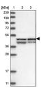 Regulator Of Microtubule Dynamics 2 antibody, NBP1-87934, Novus Biologicals, Western Blot image 