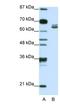 Zinc Finger Protein 57 antibody, NBP1-91550, Novus Biologicals, Western Blot image 