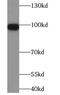 Coatomer Protein Complex Subunit Gamma 1 antibody, FNab01866, FineTest, Western Blot image 
