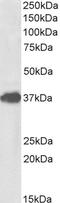 Forkhead Box F1 antibody, LS-C205015, Lifespan Biosciences, Western Blot image 