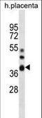 5'-Nucleotidase, Cytosolic IIIB antibody, LS-C163030, Lifespan Biosciences, Western Blot image 