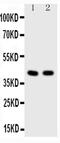 Histone Deacetylase 8 antibody, PA5-79353, Invitrogen Antibodies, Western Blot image 